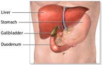 Gallstones Treatment